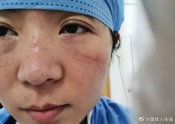 عرض الصورة على تويتر عرض الصورة على تويتر