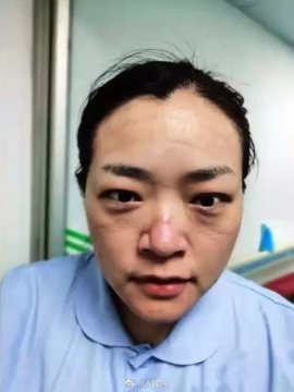 عرض الصورة على تويتر عرض الصورة على تويتر