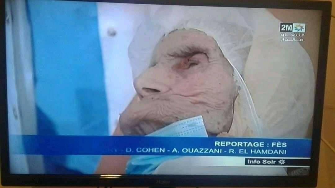 ezojvmix0aicdvq الصورة