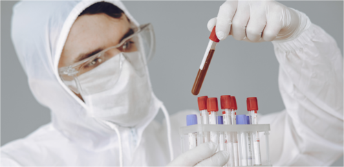 f8fec57b2738142e0e9bb589e9395b84-1 نوع فصيلة الدم قد يحدد خطر الإصابة بفيروس كورونا