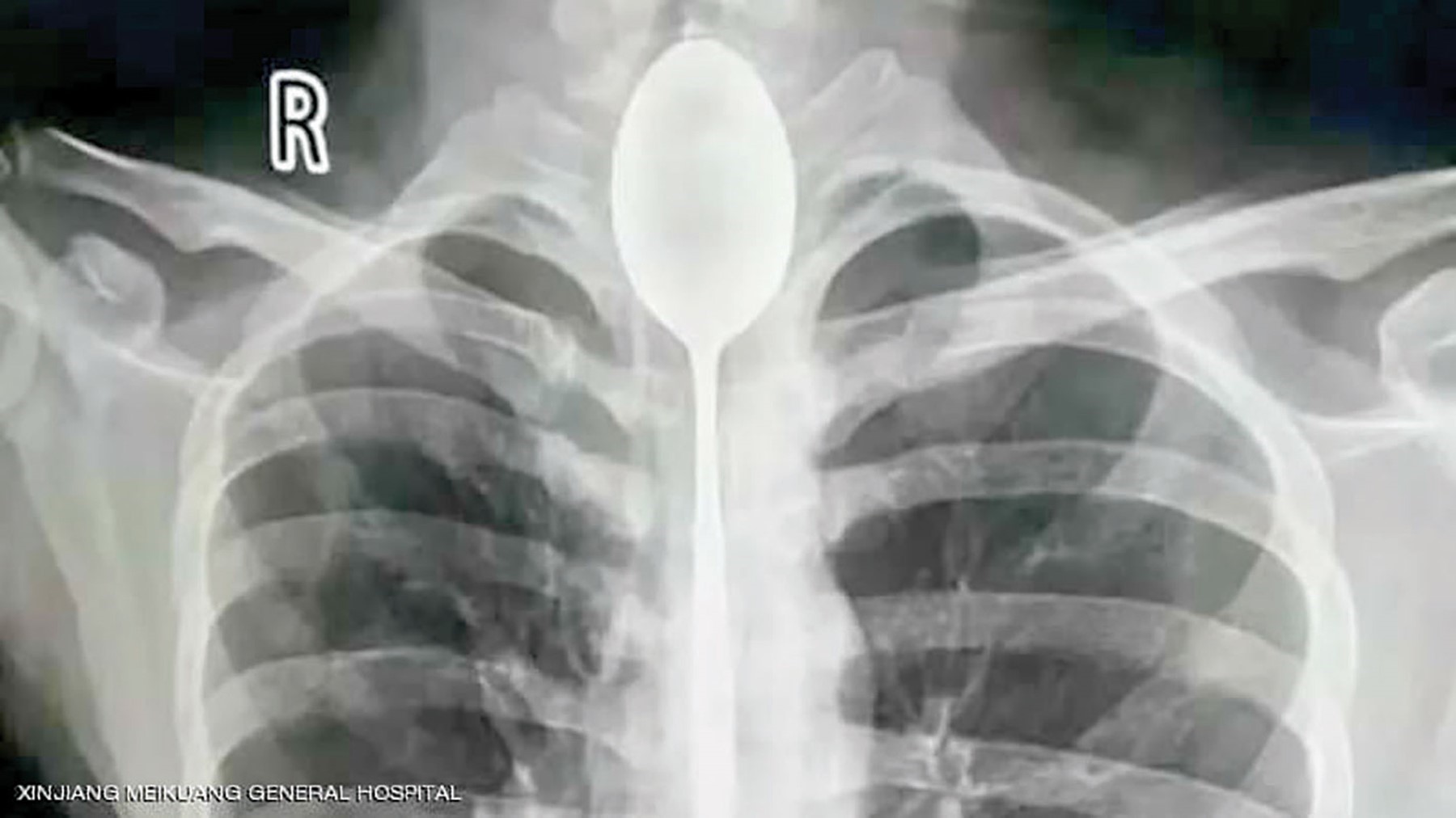 inaf_20181028011204409