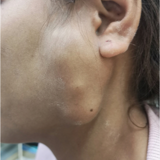 أسباب اضطرابات عصب الوجه أسباب اضطرابات عصب الوجه