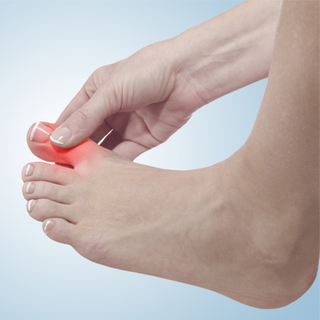 آلام المفاصل الشديدة آلام المفاصل الشديدة