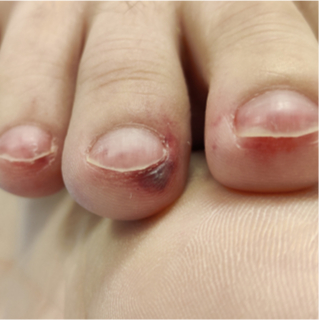 أظافر بخطوط حمراء إلى بنية أظافر بخطوط حمراء إلى بنية