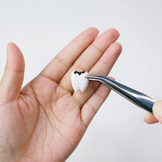 تسوس الأسنان تسوس الأسنان