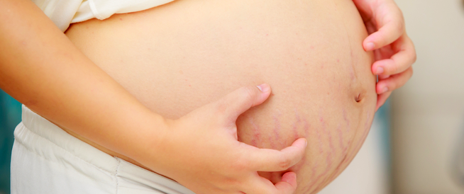 tbl_articles_article_24258_5784b14a020-d640-48de-8bb3-8c5877081f43 تشققات الحمل