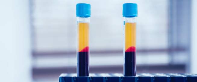 tbl_articles_article_24484_4717f19e6e4-c896-48af-94bc-d345f6bc9a8e أسباب نقص الصفائح الدموية عند الحامل