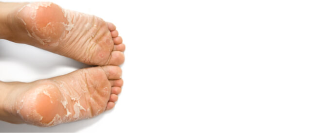 tbl_articles_article_24607_7930db85d11-60ba-46d3-958b-fb4705533373 طرق إزالة الجلد الميت من القدمين