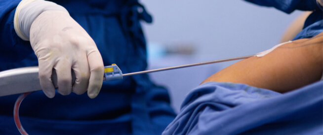 tbl_articles_article_24615_7285f815252-0987-4518-ab7f-854597eb9e17 مخاطر عملية شفط الدهون