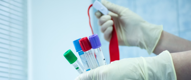 tbl_articles_article_24707_8782cb96acc-45b6-4d7d-8294-9e0e23a06261 تعرف على فحص الهرمونات للرجال