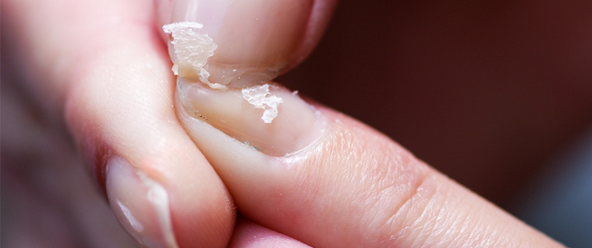 tbl_articles_article_25039_181f226595d-89c9-4bc3-a659-df357baf91e4 أسباب سقوط الأظافر عند الأطفال والبالغين