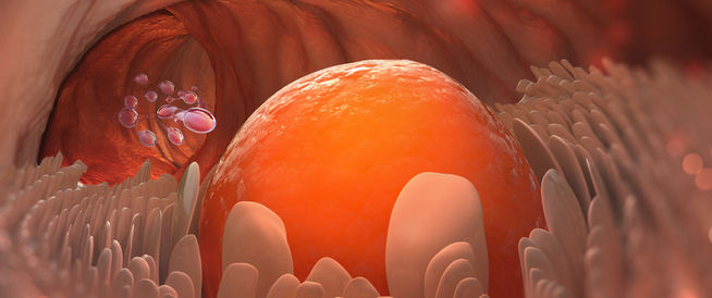 tbl_articles_article_25066_9145293105f-ddab-4ac9-ad27-e380699b3b05 سحب البويضات