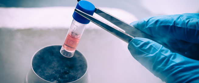 tbl_articles_article_25211_88f4b50318-56fb-4502-9319-e211b2c47316 العلاج بالخلايا الجذعية للعقم عند النساء