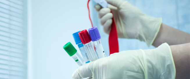 tbl_articles_article_25318_96f4d3f0c1-2106-4687-a4d2-62ee1f903e98 تحليل هرمونات السمنة