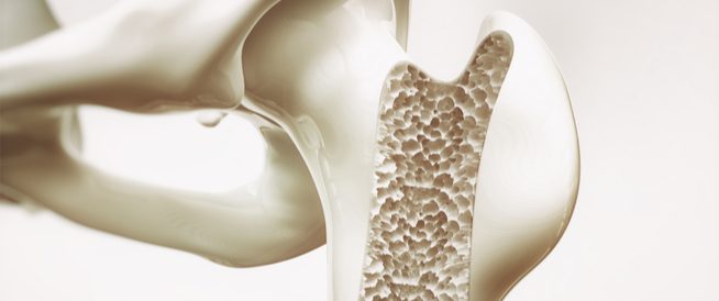 tbl_articles_article_25484_6614dba334b-a5d1-4d38-a592-9edbd29a71a2 دليلك الشامل عن تسوس العظام