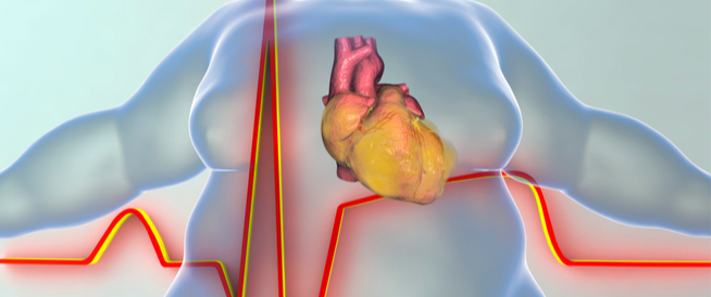 tbl_articles_article_25539_3757b597756-e595-4bd9-9d3d-7178563a4ee0 السمنة وأمراض القلب