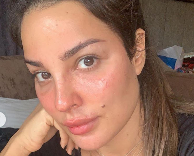 3-1-1 نادين نجيم