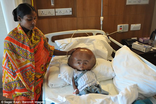 Her case drew international attention after pictures of her tragic condition were published in 2013, prompting a New Delhi hospital to offer to treat her for free