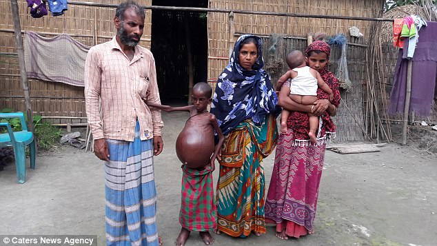 Doctors have said the only way to keep him alive will be through £2,400 surgery. Shamela and her husband Salim-ud-Din (left and middle) are urging the Government to come forward and save the life of their only son