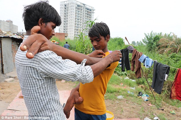 Tarik lives with his brother Hargyan, who cares for him, including helping him to dress and eat