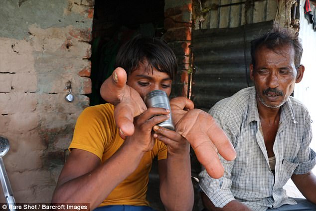 Tarik remains optimistic that he will one day have normal hands (pictured with his uncle)