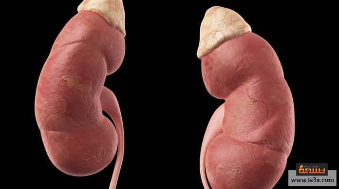 أمراض الغدة الكظرية تضخم الغدة الكظرية