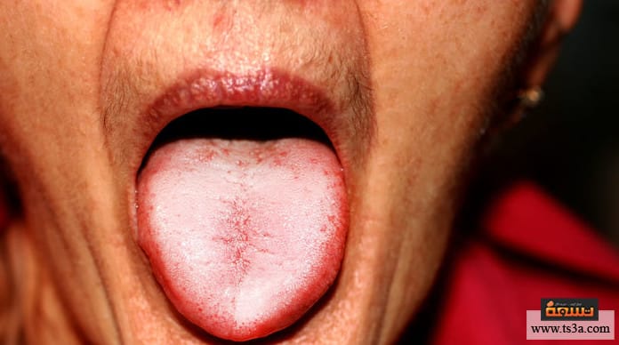 d8a3d986d98ad985d98ad8a7-d8a7d984d8add985d984-d8a3d8b9d8b1d8a7d8b6-d8a7d984d8a5d8b5d8a7d8a8d8a9-d8a8d980-d8a3d986d98ad985d98ad8a7-d8a7d984d8add985d984-d89f أنيميا الحمل خطر الأنيميا أثناء الولادة