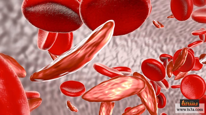 d8a3d986d98ad985d98ad8a7-d8a7d984d8add985d984-d985d8a7-d8a7d984d985d982d8b5d988d8af-d8a8d980-d8a3d986d98ad985d98ad8a7-d8a7d984d8add985d984-d89f أنيميا الحمل ما المقصود بـ أنيميا الحمل ؟