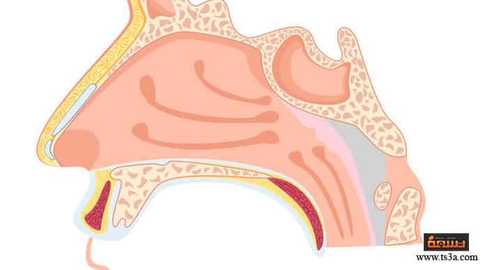اللحمية عند الأطفال مضاعفات تضخم اللحمية عند الأطفال وعلاجها
