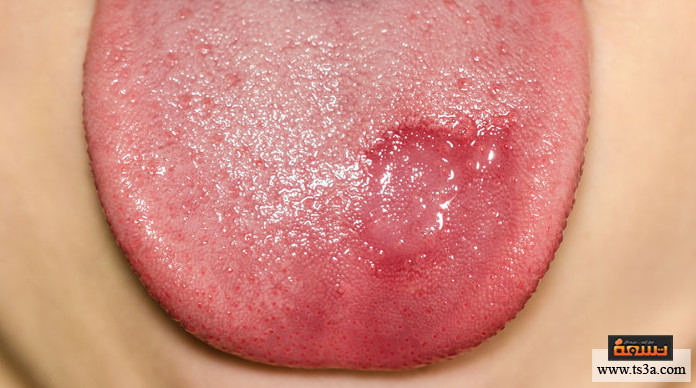 اللسان الجغرافي أنواع اللسان الجغرافي