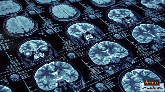 d8aad8a3d8abd98ad8b1-d8a7d984d985d8bad986d8a7d8b7d98ad8b3d98ad8a9-d8b9d984d989-d8a7d984d8acd8b3d8af-d8aad8a3d8abd98ad8b1-d8a7d984d985d8bad986d8a7d8b7d98ad8b3-d8b9d984d989-d8a7d984d8afd985d8a7d8ba تأثير المغناطيسية على الجسد تأثير المغناطيس على الدماغ