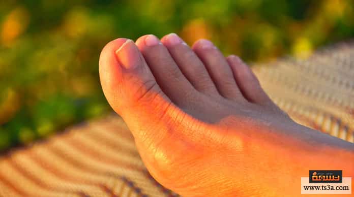 d8aad988d8b1d985-d8a7d984d8a3d8b5d8a7d8a8d8b9-d8b9d984d8a7d8ac-d8aad988d8b1d985-d8a7d984d8a3d8b5d8a7d8a8d8b9-d8a8d8a7d984d8a3d8b9d8b4d8a7d8a8 تورم الأصابع علاج تورم الأصابع بالأعشاب