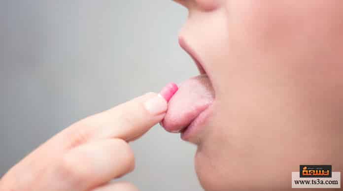 d8acd981d8a7d981-d8a7d984d984d8b3d8a7d986-d988d8b5d981d8a7d8aa-d8b7d8a8d98ad8b9d98ad8a9-d984d984d982d8b6d8a7d8a1-d8b9d984d989-d8acd981d8a7d981-d8a7d984d984d8b3d8a7d986 جفاف اللسان وصفات طبيعية للقضاء على جفاف اللسان
