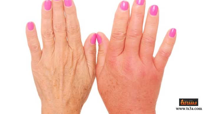 حمض الماليك الآثار الجانبية لحمض الماليك