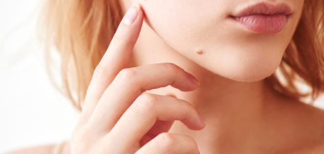 طرق إزالة الشامات من الوجه بالأعشاب: وردّ أخصائيي التجميل والمختصين