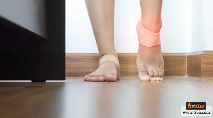 علاج الشوكة العظمية بالثوم طرق الوقاية من الإصابة بالشوكة العظمية