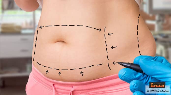 عملية تجميل رخيصة كيف تحصل على عملية تجميل رخيصة وجيدة؟