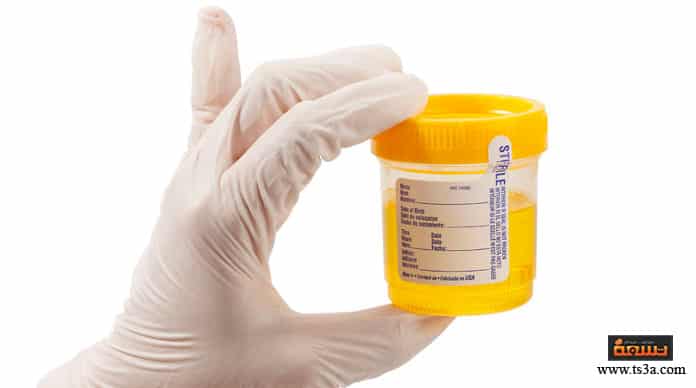 d982d8b1d8a7d8a1d8a9-d8a7d984d8aad8add8a7d984d98ad984-d8a7d984d8b7d8a8d98ad8a9-d982d8b1d8a7d8a1d8a9-d8a7d984d8aad8add8a7d984d98ad984-d8a7d984d8b7d8a8d98ad8a9-d984d984d8a8d988d984 قراءة التحاليل الطبية قراءة التحاليل الطبية للبول