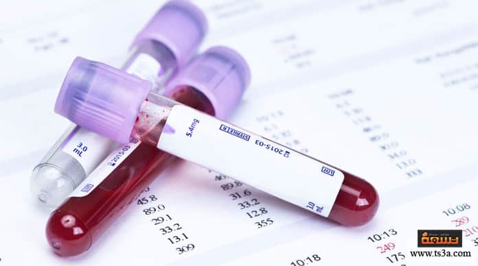 d982d8b1d8a7d8a1d8a9-d8a7d984d8aad8add8a7d984d98ad984-d8a7d984d8b7d8a8d98ad8a9-d982d8b1d8a7d8a1d8a9-d8a7d984d8aad8add8a7d984d98ad984-d8a7d984d8b7d8a8d98ad8a9-d984d984d8afd985 قراءة التحاليل الطبية قراءة التحاليل الطبية للبول