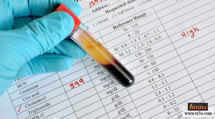 d982d8b1d8a7d8a1d8a9-d8a7d984d8aad8add8a7d984d98ad984-d8a7d984d8b7d8a8d98ad8a9-d983d98ad981d98ad8a9-d982d8b1d8a7d8a1d8a9-d8aad8add984d98ad984-d8a7d984d8afd985-d8a7d984d8b4d8a7d985d984 قراءة التحاليل الطبية كيفية قراءة تحليل الدم الشامل