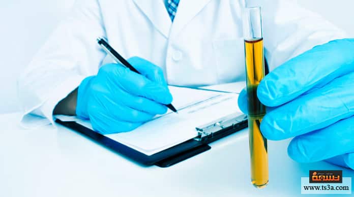 d984d988d986-d8a7d984d8a8d988d984-d984d988d986-d8a7d984d8a8d988d984-d8a7d984d8b7d8a8d98ad8b9d98a لون البول لون البول الطبيعي