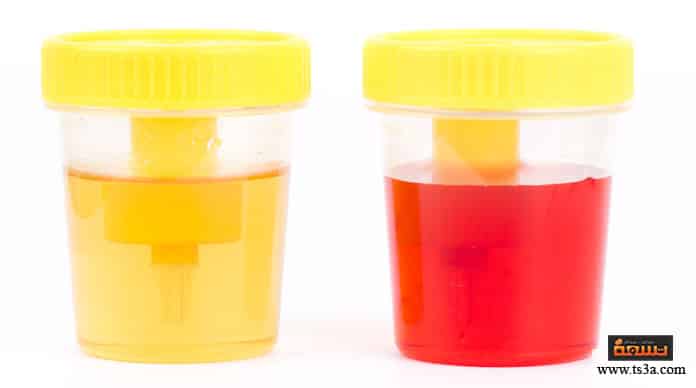 d984d988d986-d8a7d984d8a8d988d984-d984d988d986-d8a7d984d8a8d988d984-d988d986d988d8b9-d8a7d984d8acd986d98ad986 لون البول لون البول ونوع الجنين