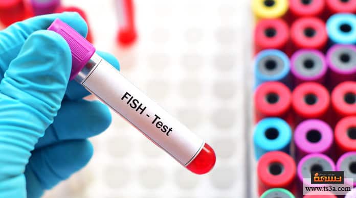 متلازمة تيرنر متلازمة تيرنر والحمل