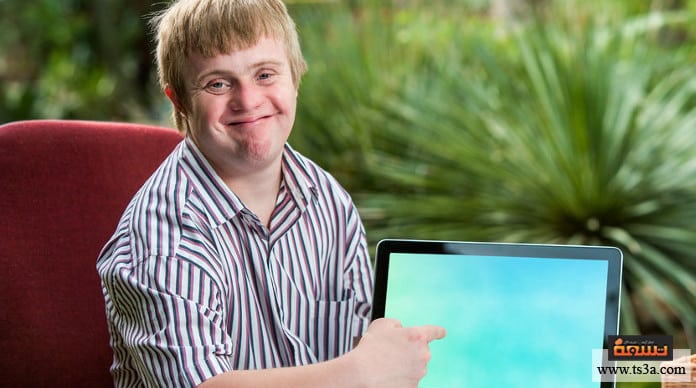 d985d8aad984d8a7d8b2d985d8a9-d8afd8a7d988d986-d8a3d8b9d8b1d8a7d8b6-d985d8aad984d8a7d8b2d985d8a9-d8afd8a7d988d986-d8a7d984d8acd8b3d8afd98ad8a9 متلازمة داون أعراض متلازمة داون الجسدية