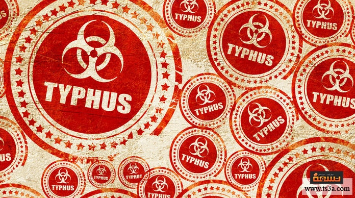 d985d8b1d8b6-d8a7d984d8aad98ad981d988d8b3-d983d98ad981-d98ad8aad985-d8aad8b4d8aed98ad8b5-d985d8b1d8b6-d8a7d984d8aad98ad981d988d8b3-d988d8b9d984d8a7d8acd987d89f مرض التيفوس كيف يتم تشخيص مرض التيفوس وعلاجه؟