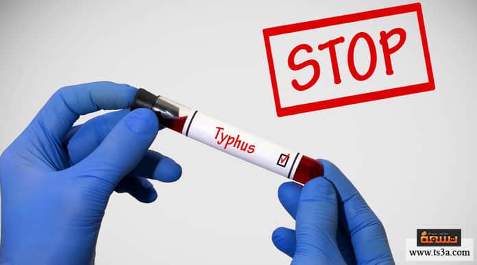 d985d8b1d8b6-d8a7d984d8aad98ad981d988d8b3-d985d8a7-d987d98a-d8a3d8b3d8a8d8a7d8a8-d985d8b1d8b6-d8a7d984d8aad98ad981d988d8b3d89f مرض التيفوس ما هي أسباب مرض التيفوس؟