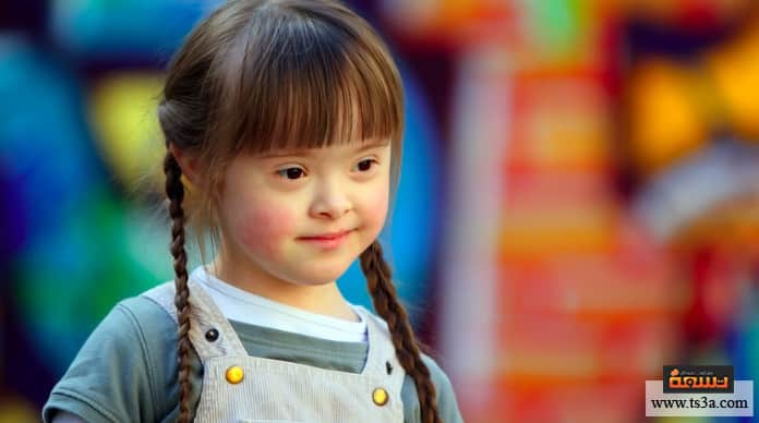 d985d8b4d8a7d983d984-d8b9d982d984d98ad8a9-d8a3d8b3d8a8d8a7d8a8-d8a7d984d8aad8aed984d981-d8a7d984d8b9d982d984d98a مشاكل عقلية أسباب التخلف العقلي