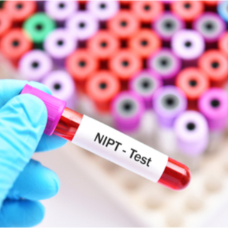 عوامل خطر الإصابة بمتلازمة داون عوامل خطر الإصابة بمتلازمة داون