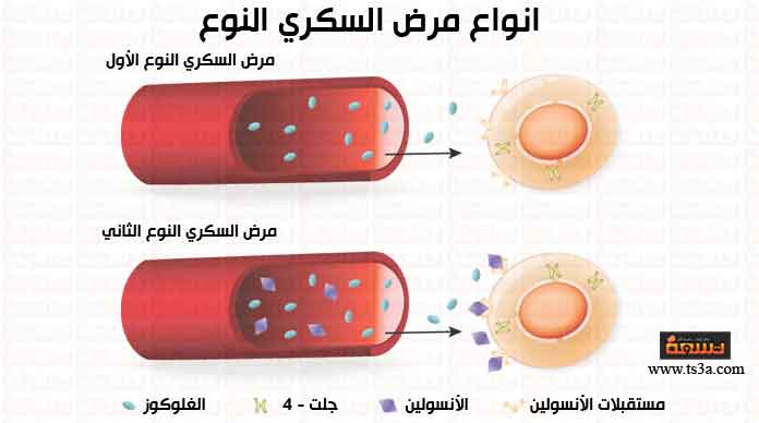 مرض السكري