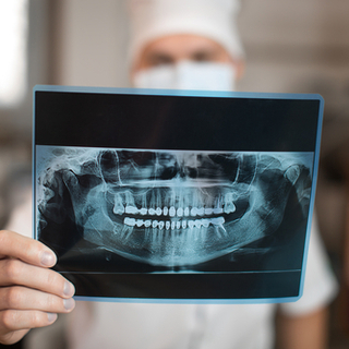 تشخيص أمراض اللثة بالصور تشخيص أمراض اللثة بالصور